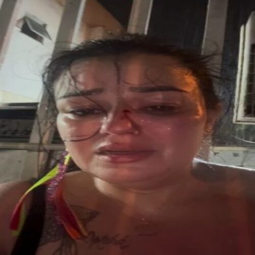 Marcele Pata, ex-vereadora por Campos, diz ter sido agredida pelo namorado